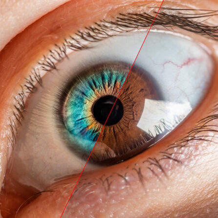 Genetyczne choroby oczu – dziedziczne problemy ze wzrokiem